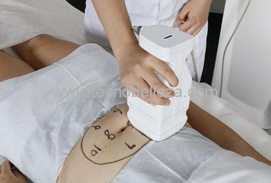 LIPOSONIX VERTICAL TB - Imagen 2