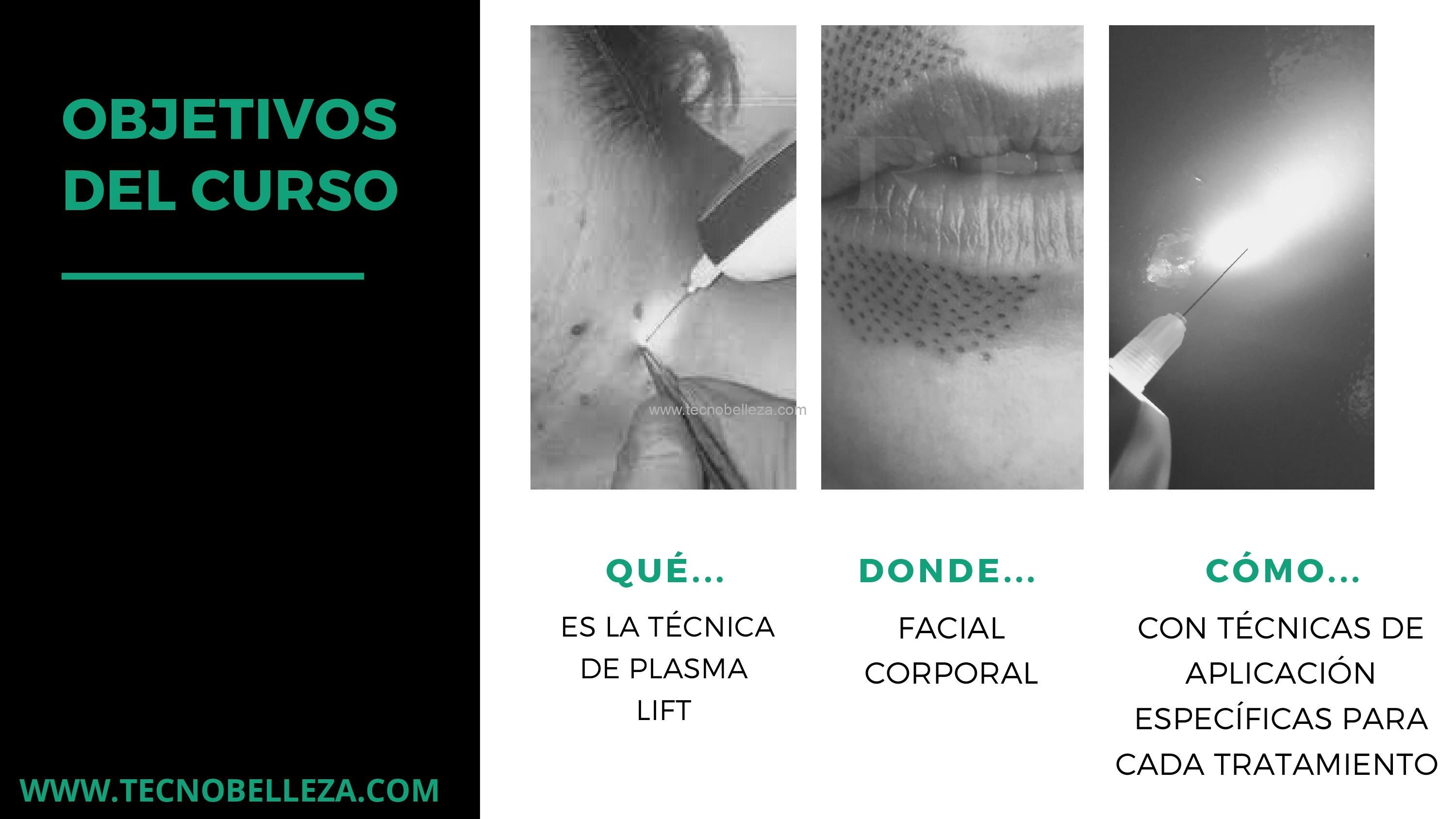 CURSO + KIT INICIACIÓN PLASMA LIFT - Imagen 4