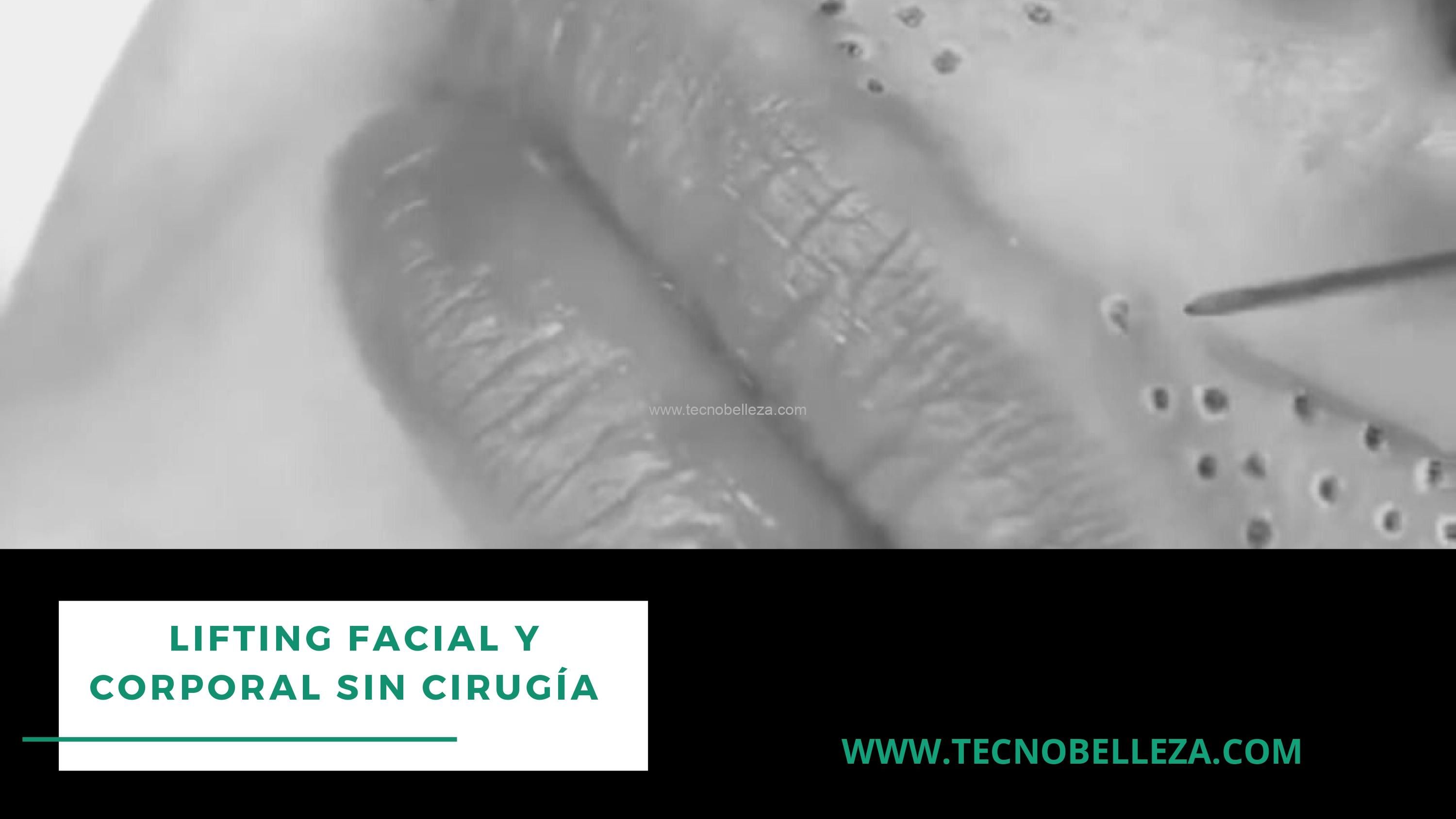 CURSO + KIT INICIACIÓN PLASMA LIFT - Imagen 5