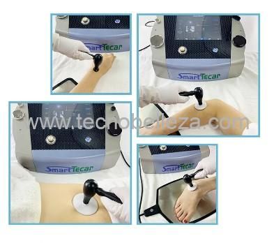 Diatermia Tecno Smart - Imagen 3